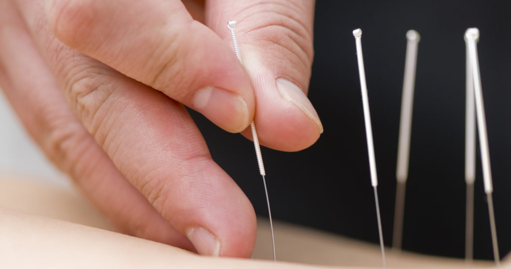 Altanta Pain Doctor Alternative Therapies for Pain